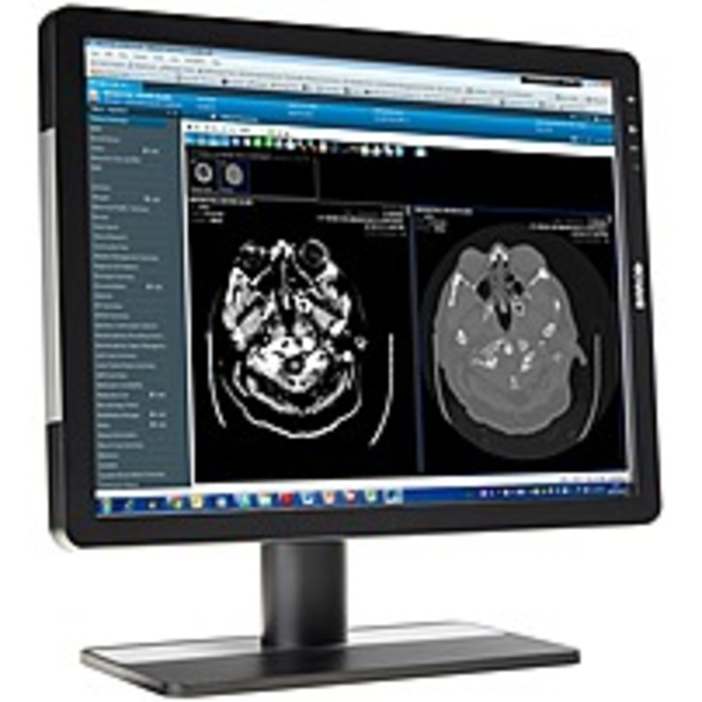 Barco K9301880A - Barco Eonis MDRC-2221 21.3 LCD Monitor - 4:3 - 20 ms - 1600 