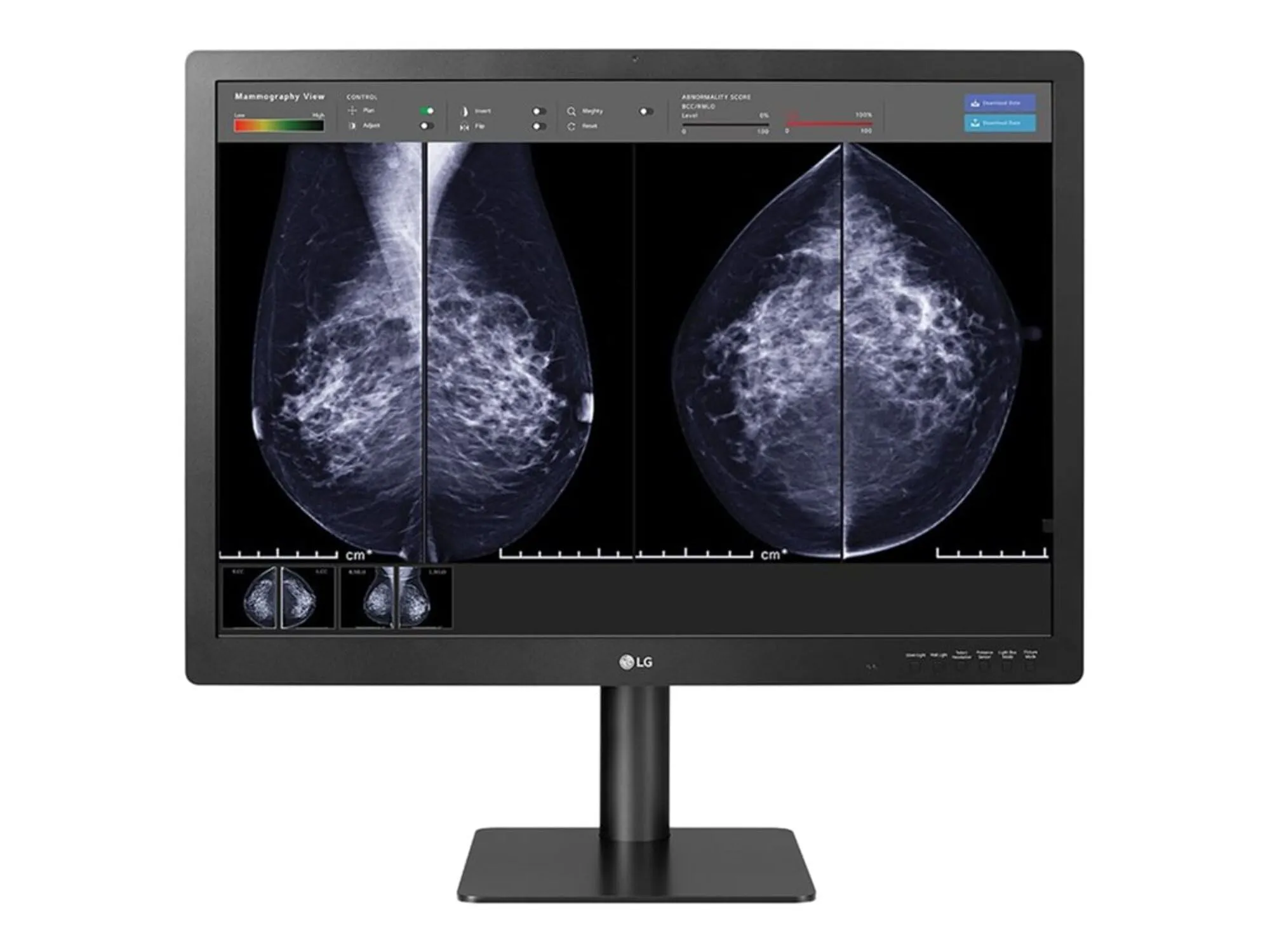 LG Electronics 31HN713D-B — LG, 31 MEDICAL ANTI-GLARE, 3H DIAGNOSTIC MONITOR 4200 X 2800 (3:2) CLASS II FDA 510K